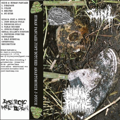 Botched Anastomosis J-Pouch : Junt - Botched Anastomosis J-Pouch - Human Pancake